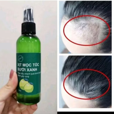 TINH DẦU BƯỞI XỊT KÍCH MỘC TÓC CAO CẤP CHO MỌI GIA ĐÌNH 