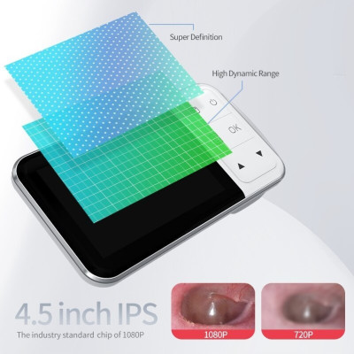 ROGTZ - Camera Nội Soi Tai Mũi Họng C02 Lens 3.9mm Màn Hình 4.5 Inch LCD Kỹ Thuật Số Phân Giải 1920*1080 6LED Hỗ Trợ Chụp Nhanh Và Quay Video 1080P Pin 2500mAh 4-5h Chống Nước IP67 Tai Mũi Họng Cơ Thể Bên Trong  - Hàng Chính Hãng