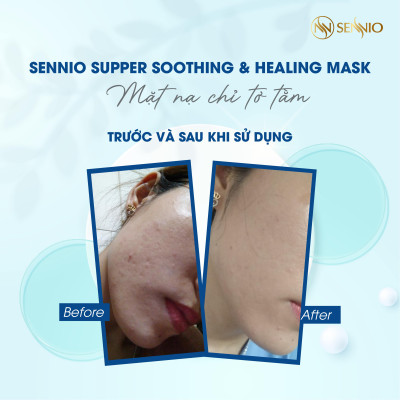 Mặt nạ giấy dưỡng trắng da Sennio Super Soothing & Healing Mask dưỡng ẩm, phục hồi da 23 ml SNO 822