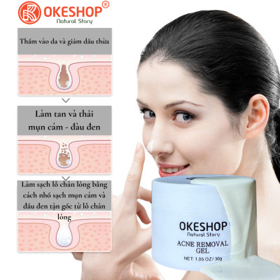 Gel Lột Mụn OKESHOP 30ml - Giải Pháp Loại Bỏ Mụn Đầu Đen - Mụn Cám - Bạ Nhờn - Làm Sạch Sâu Và Thu Nhỏ Lỗ Chân Lông
