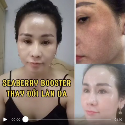 Seaberry Booster Mẹ Ken (30ml) Detox SkinCare