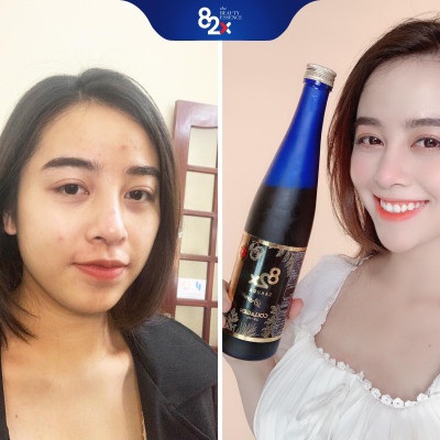ĐẸP NÕN NÀ - DA PHỦ SƯƠNG CĂNG MƯỚT Combo 3 Chai: COLLAGEN + SAKURA COLLAGEN + SAKURA PLACENT Nước Uống Đẹp Da Nhật Bản