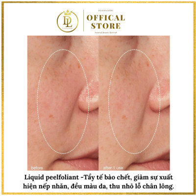 Tẩy tế bào chết hóa học giúp giảm sự xuất hiện nếp nhăn, đều màu da, thu nhỏ lỗ chân lông Dermalogica Liquid Peelfoliant 59ml