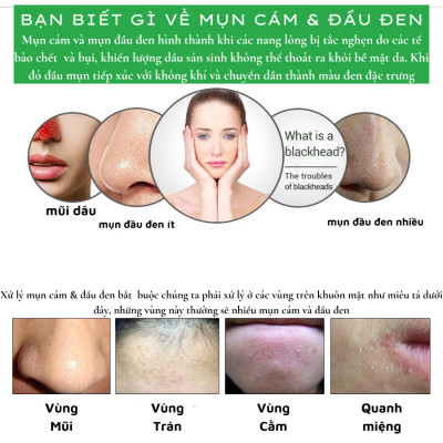 Gel Lột Mụn Nha Đam OKESHOP 30ml - Giải Pháp Loại Bỏ Mụn Đầu Đen - Mụn Cám - Bạ Nhờn - Làm Sạch Sâu Và Thu Nhỏ Lỗ Chân Lông