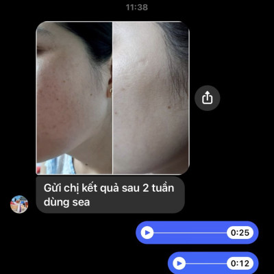 Seaberry Booster Mẹ Ken (30ml) Detox SkinCare