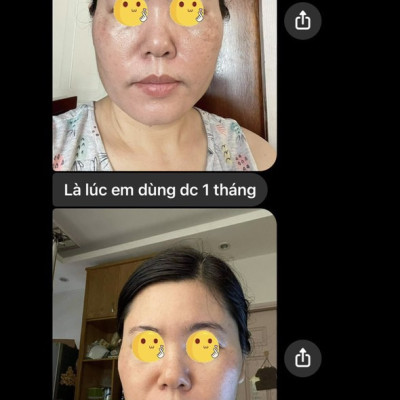 Seaberry Booster Mẹ Ken (30ml) Detox SkinCare