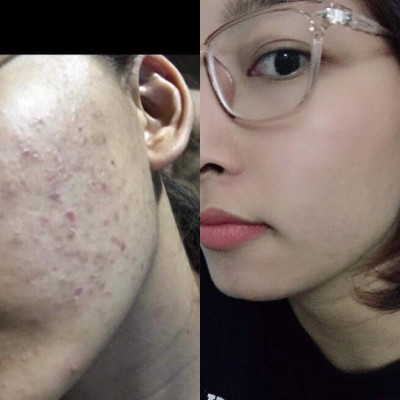 Seaberry Booster Mẹ Ken (30ml) Detox SkinCare