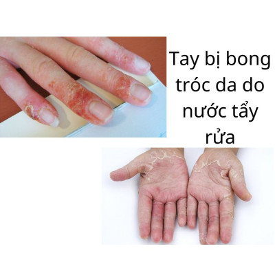 Găng Tay Cao Su Tự Nhiên Hàn Quốc Thương Hiệu BEIGL Có Móc Đủ Kích Cỡ