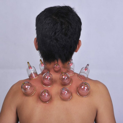 Bộ Giác Hơi Không Dùng Lửa Duy Thành YGH05 (6 ống giác)