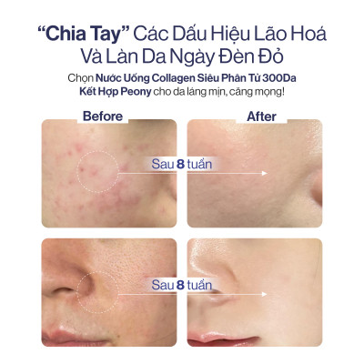 NƯỚC UỐNG COLLAGEN GILAA SIÊU PHÂN TỬ 300DA GILAA KẾT HỢP PEONY TRẺ HÓA CÂN BẰNG NỘI TIẾT (20g x 15 gói)